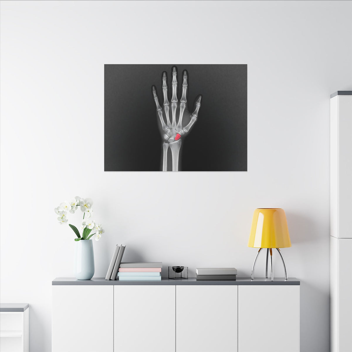 Carpal Study - Doctor's Office Wall Art | Canvas (Landscape)