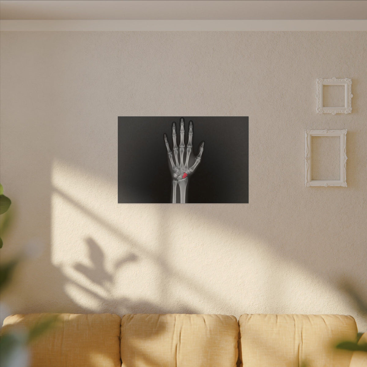 Carpal Study - Doctor's Office Wall Art | Canvas (Landscape)