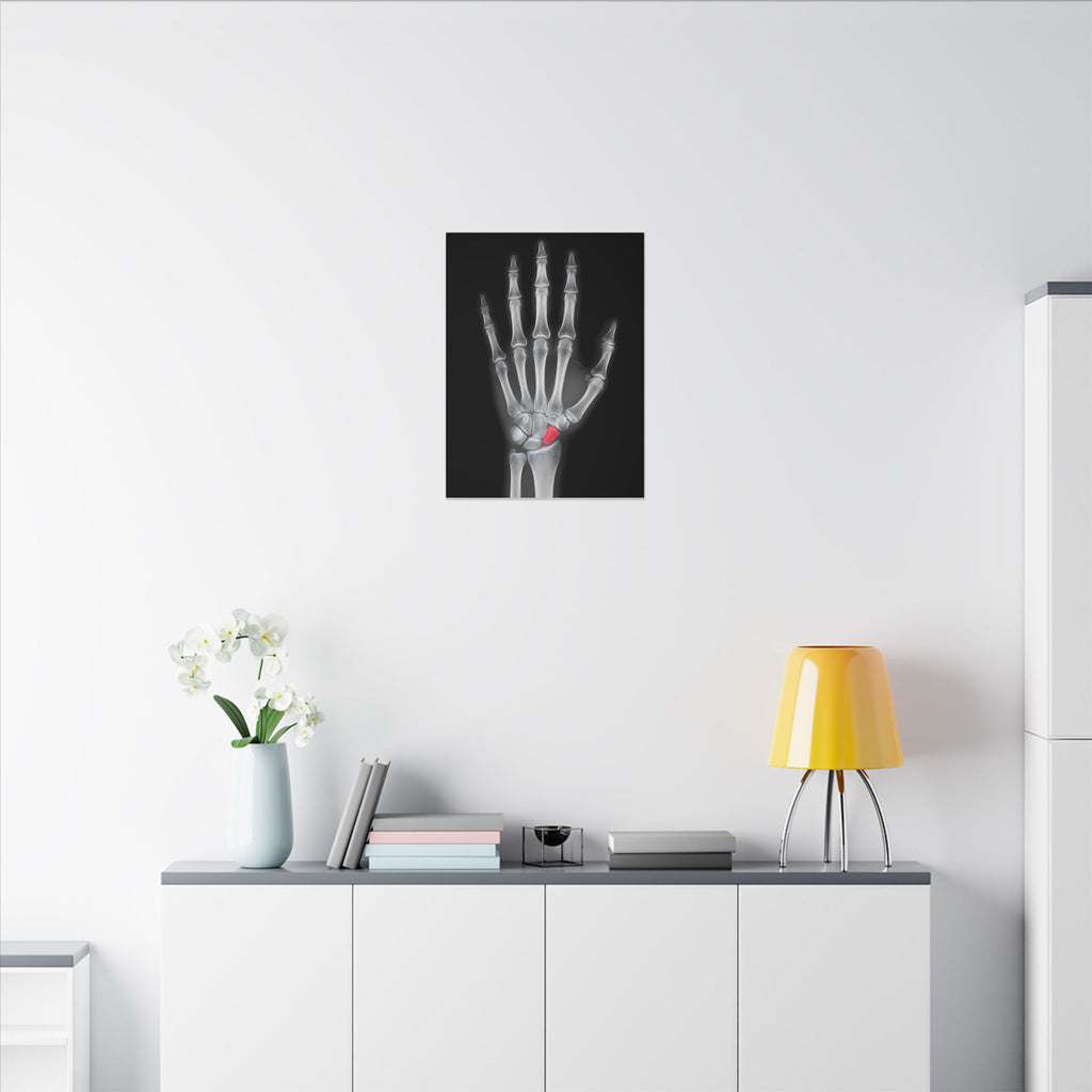 Carpal Study - Doctor's Office Wall Art | Canvas