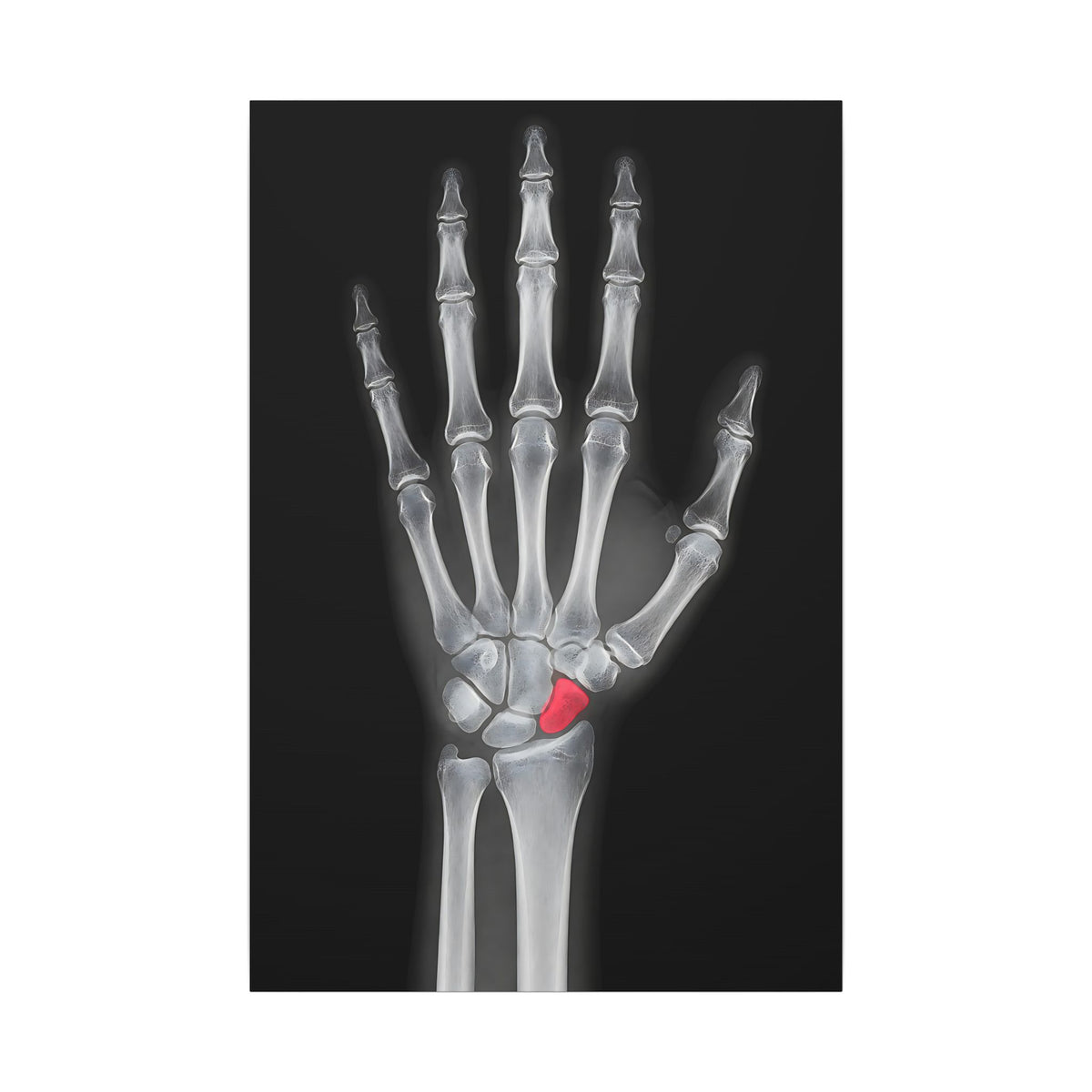 Carpal Study - Doctor's Office Wall Art | Canvas