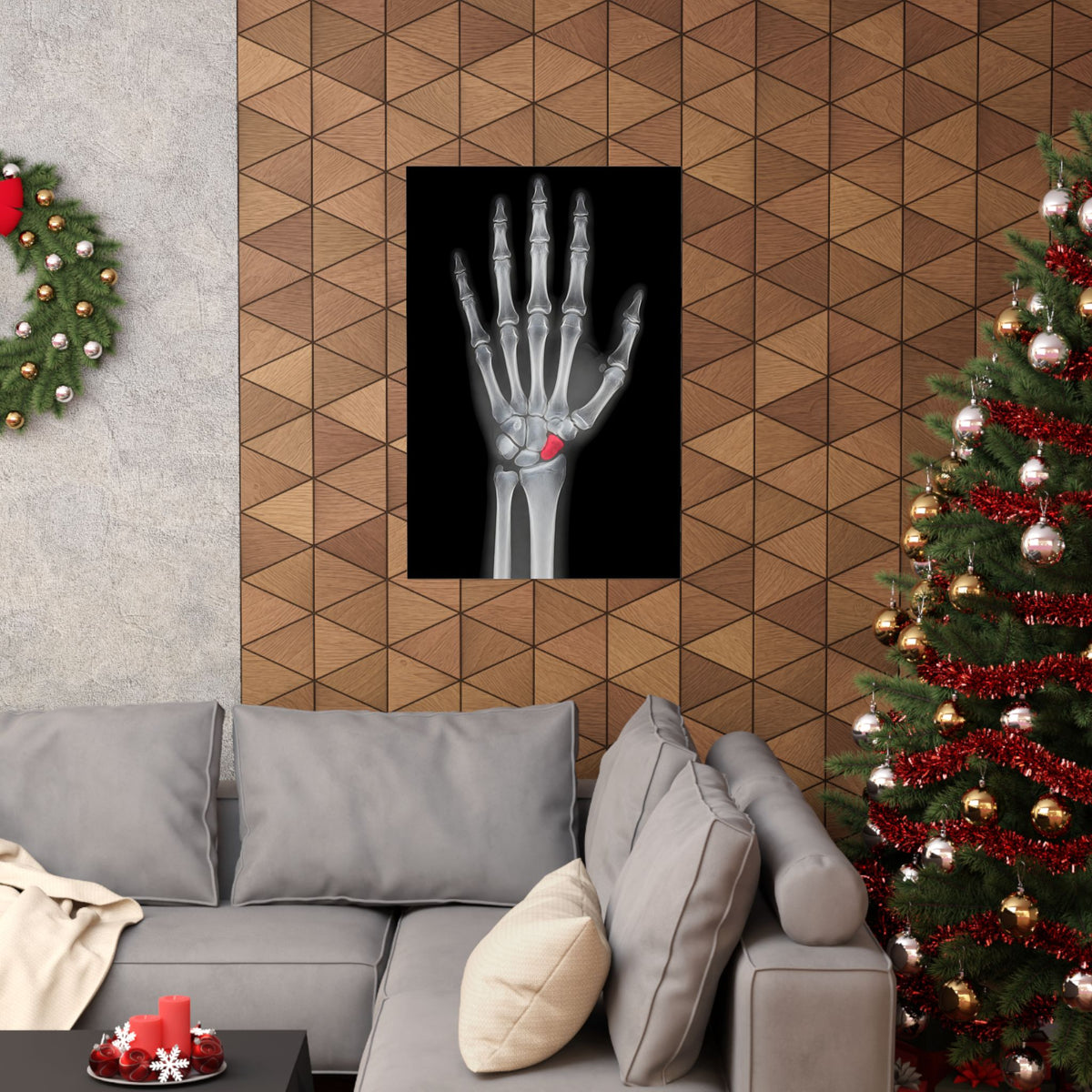 Carpal Study - Doctor's Office Wall Art | Matte Poster