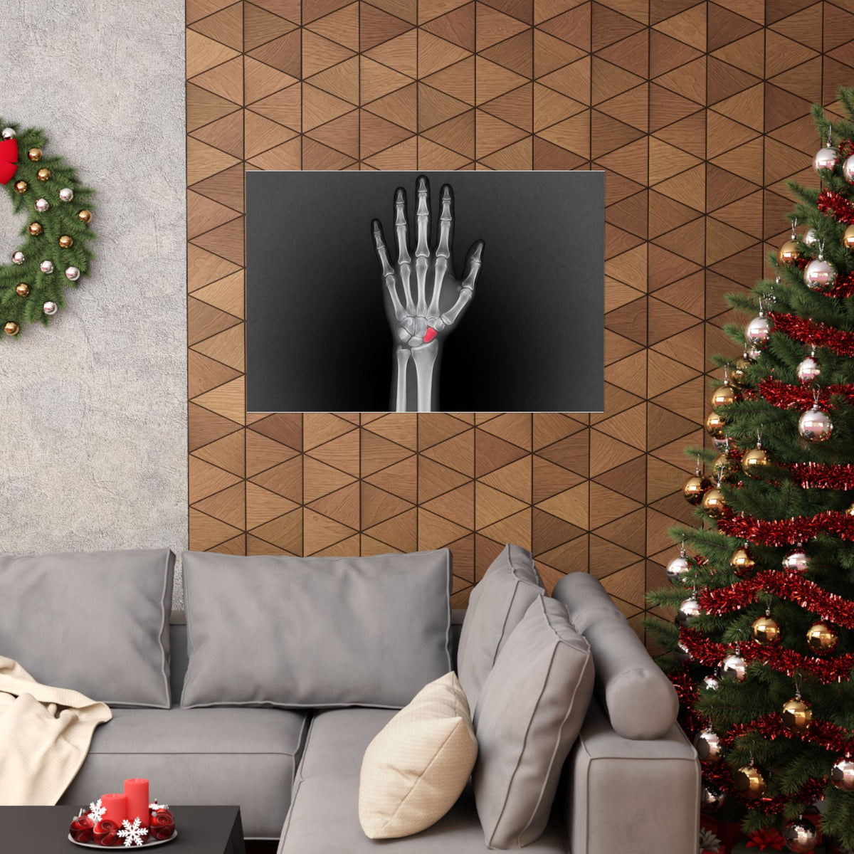 Carpal Study - Doctor's Office Wall Art | Matte Poster (Landscape)